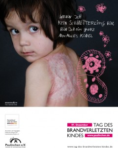 Aktionsflyer "Tag des brandverletzten Kindes"